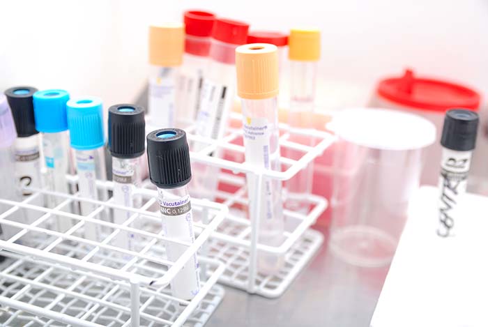 Phlebotomy Classes near me