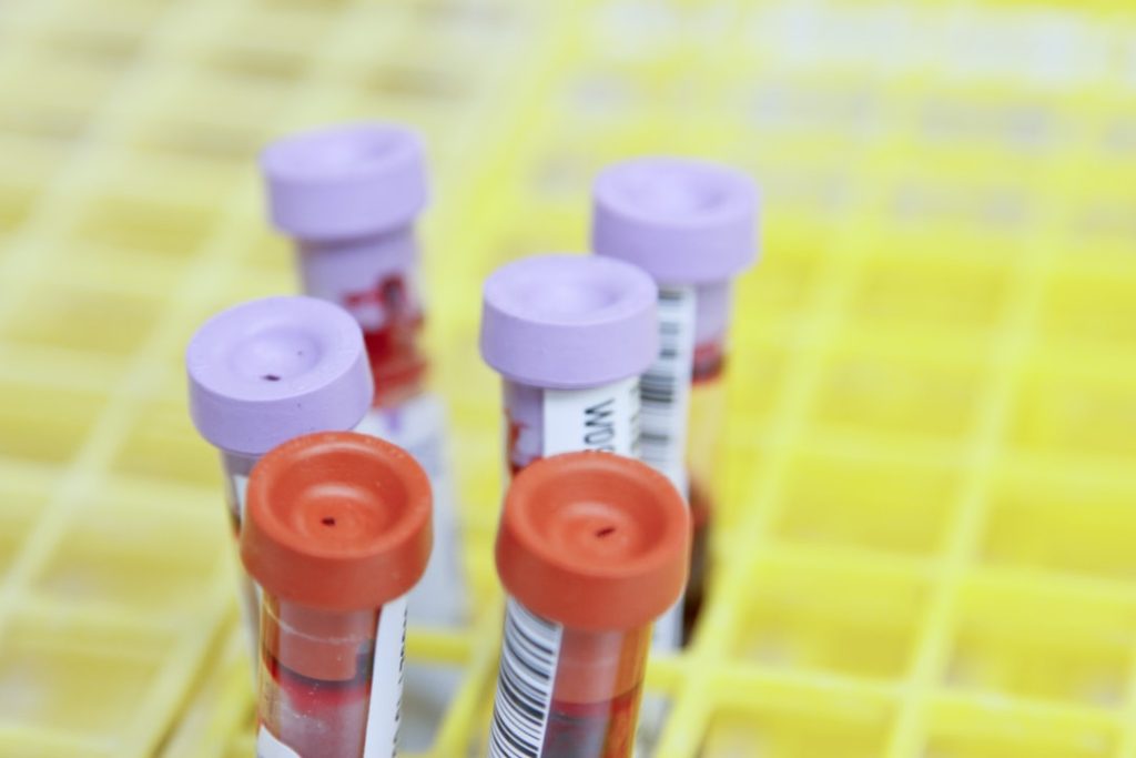 Phlebotomy Technician Certification in Illinois