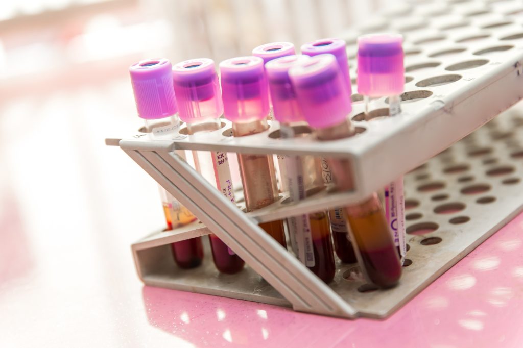 Phlebotomy technician jobs in illinois